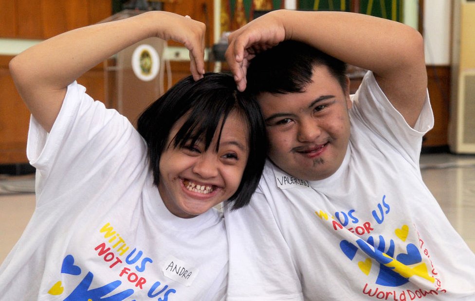 Svetski dan ljudi sa Daunovim sindromom: Koji su njegovi znaci i da li može da se leči 1 Deca, Daunov sindrom