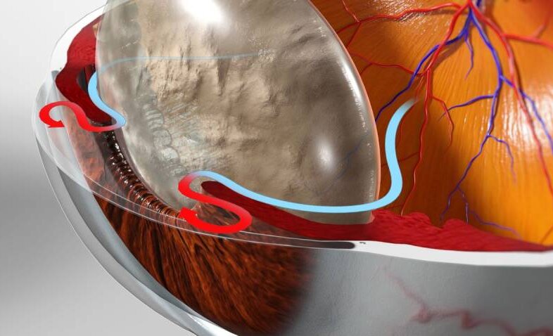 Nedelja borbe protiv glaukoma u UKC Kragujevac 1