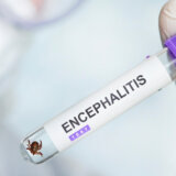 Nemački grad poslao upozorenje zbog opasne virusne bolesti 5