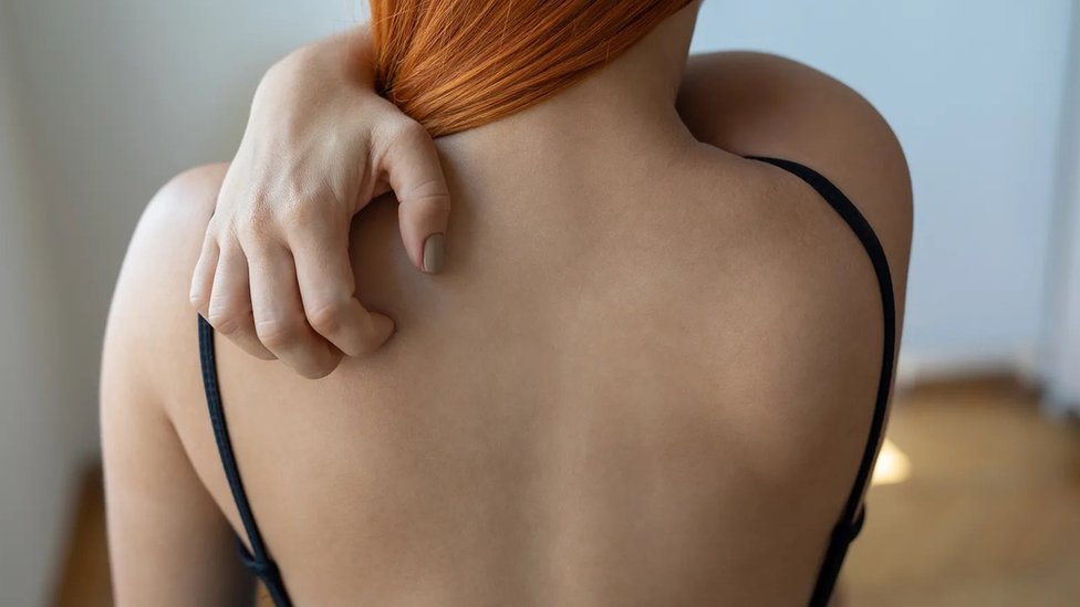 Medicina: Novi lek koji bi mogao da izleči hronični svrab 1 svrab, svrabež, češanje