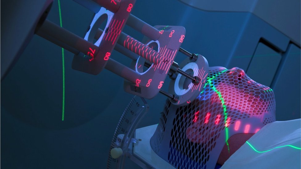 Kvantna era: Cenjeni fizičar Mičio Kaku predviđa lek za rak i moguću pretnju veštačke inteligencije 4 Ilustracija lečenja obolelog od raka