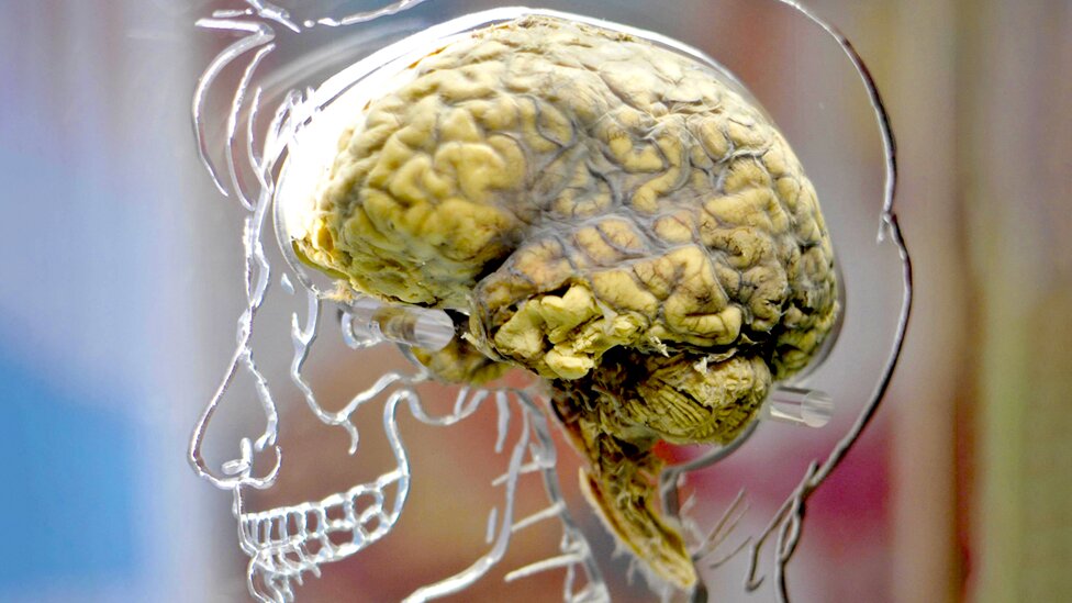 Mladi u Srbiji i mentalno zdravlje: Šta je digitalna demencija i može li se sprečiti 1 mozak, ljudski mozak