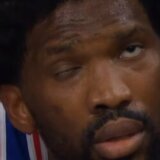 Embidu ukočena polovina lica: Centar Filadelfije otkrio od čega boluje (VIDEO) 12