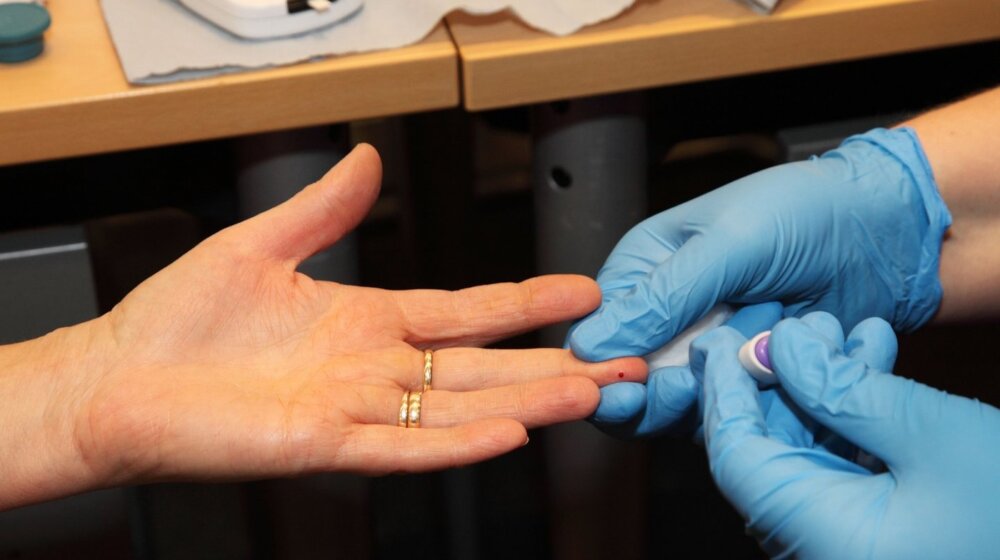 Znaci koji pokazuju da imate visok holesterol u krvi 1