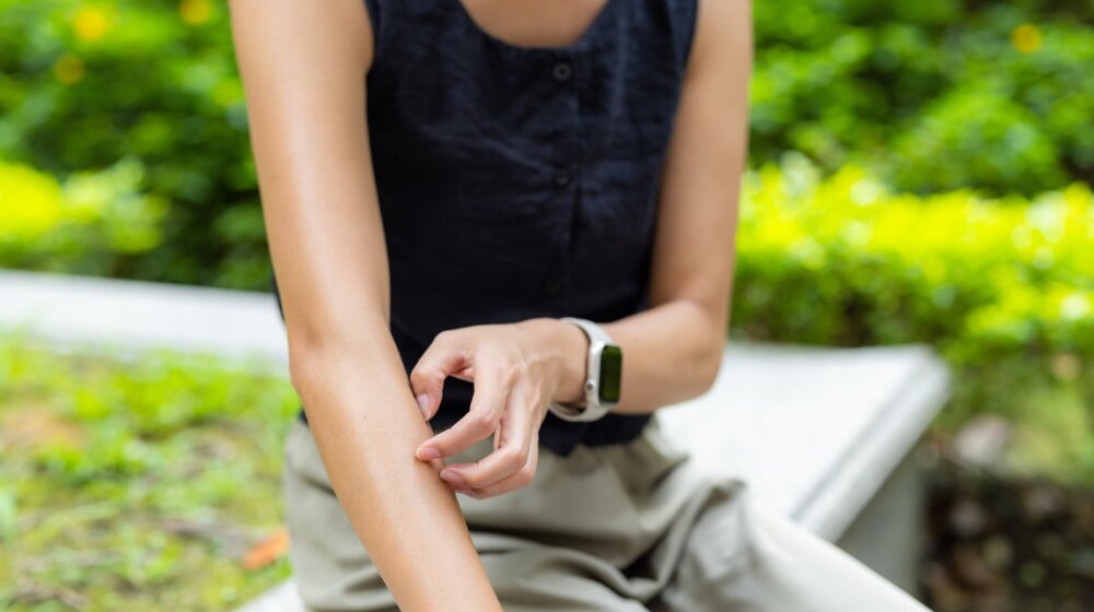 Ovo sme da se stavlja, a ovo ne na mesto uboda insekta, opekotinu ili ranu 1