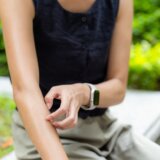 Ovo sme da se stavlja, a ovo ne na mesto uboda insekta, opekotinu ili ranu 3