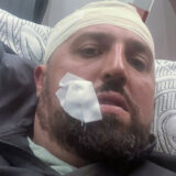 Kosovo online: Kosovski specijalci pretukli Srbina i pretili mu pištoljem kod Zubinog Potoka 4