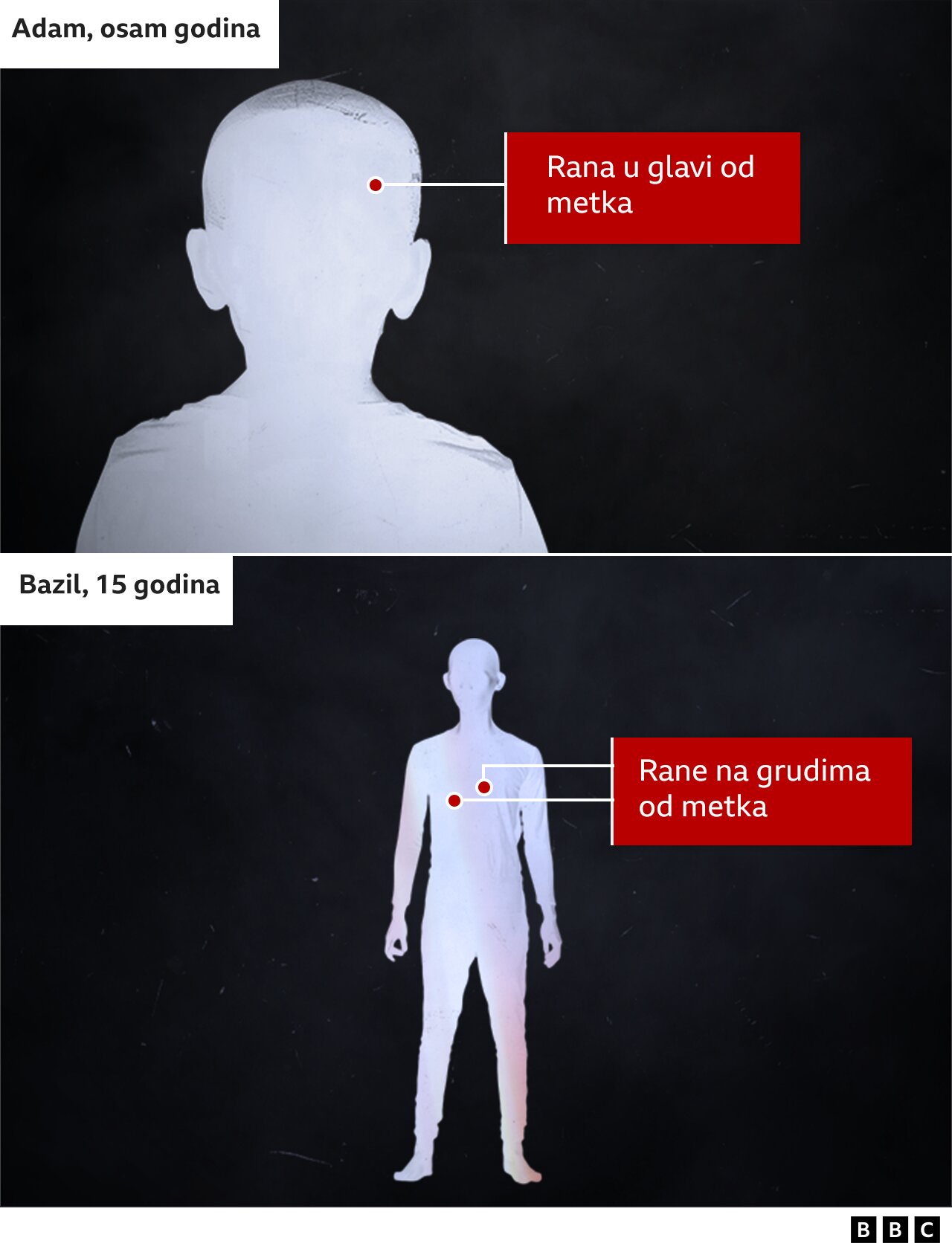 Ubistvo palestinskog dečaka na Zapadnoj obali deluje kao ratni zločin izraelske vojske, tvrdi ekspert UN-a pošto je video dokaze koje je sakupio BBC 4 grafička rekonstrukcija povreda