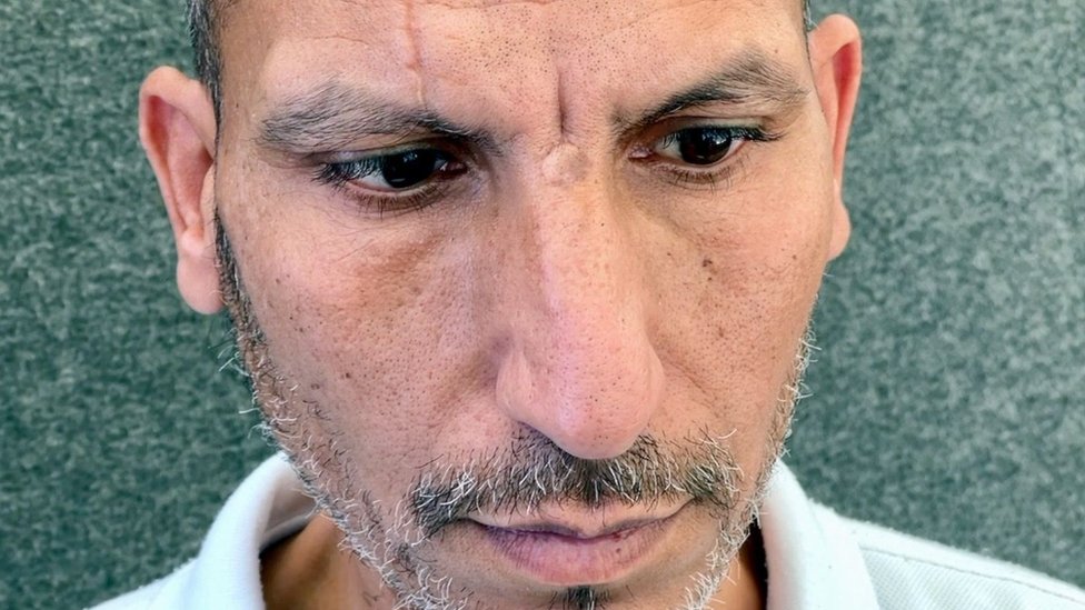 Izrael i Palestinci: Stanovnici Gaze „vezani lisicama i sa povezom preko očiju“ u izraelskoj bolnici 1 Sufijan Abu Salah