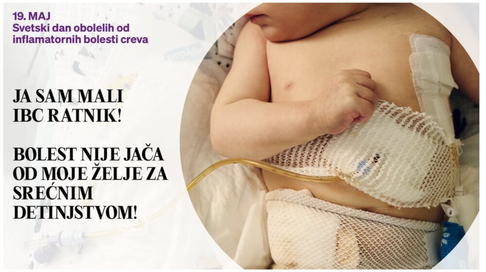 19. maj - Svetski dan zapaljenskih bolesti creva 1