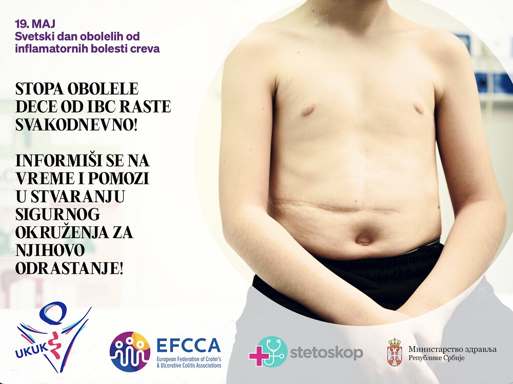 19. maj - Svetski dan zapaljenskih bolesti creva 2