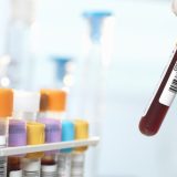 Pojavio se grip: Potrvrđena tri slučaja u Srbiji 4