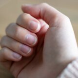 Ova mala promena na noktu može biti simptom raka 11
