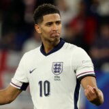 Belingem ima čudne tamne mrlje po licu, evo o čemu je reč 11