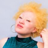 „Moj silovatelj je verovao da će ga napad na albino osobu zaštititi od bolesti" 10