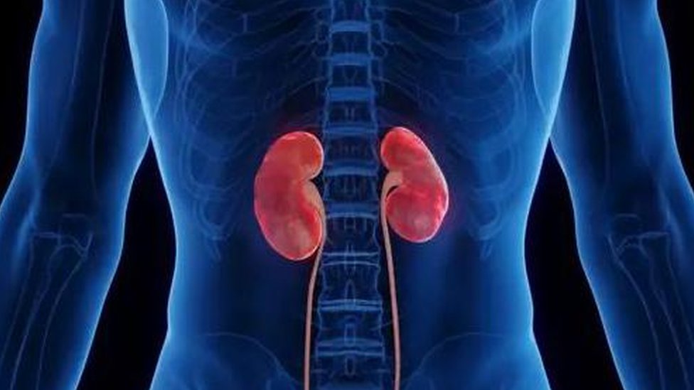 Trovanje metanolom: Kako telo reaguje na ilegalna alkoholna pića 6 Rendgen ljudskog tela na kom se vide bubrezi