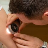 Priliku za besplatan pregled mladeža iskoristilo je 4.470 građana, među kojima je otkriveno 255 sumnjivih slučajeva 1