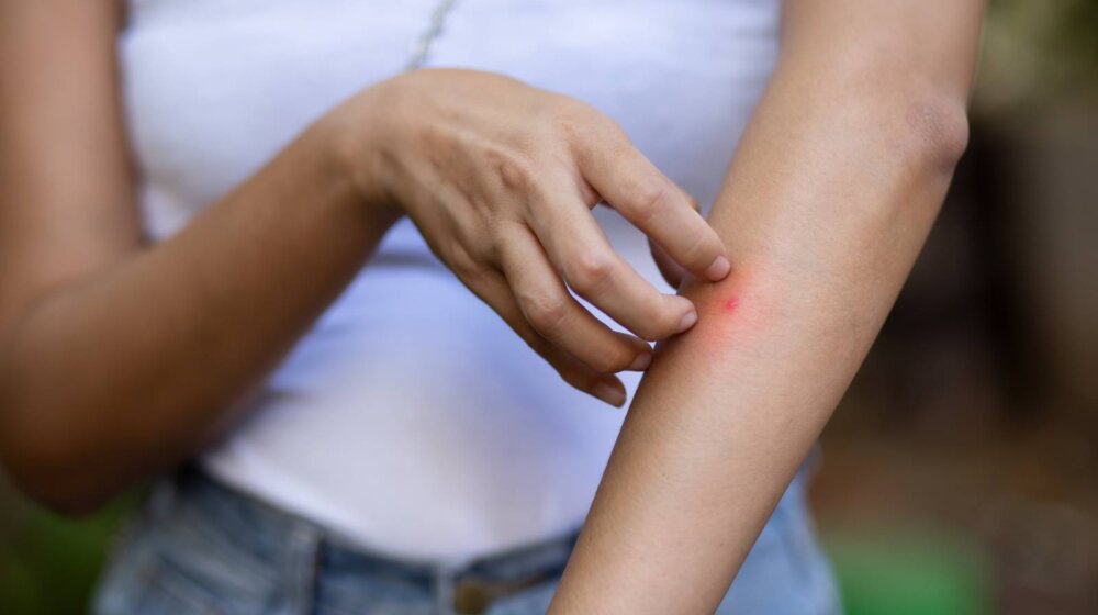 prirodan repelent, komarci