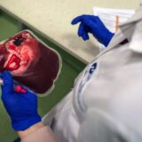 Zdravlje: Može li sačuvana krv iz pupčane vrpce pomoći u lečenju određenih naslednih bolesti 4