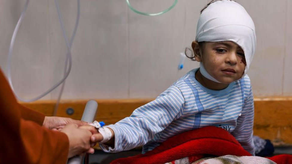 Dečak sa zavojem oko glave drži za ruku odraslu osobu