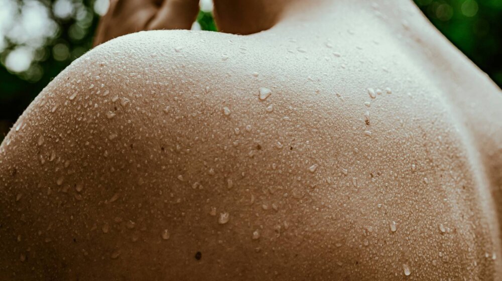 Koliko se znojite? Evo u kojim slučajevima bi trebalo da se obratite lekaru 1