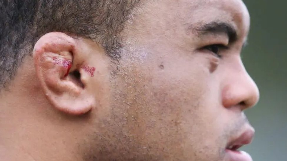 Od zdravlja do sporta kojim se bavite: Šta sve uši otkrivaju o vama 7 Uho