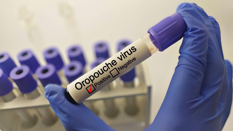 Šta je oropuš virus i ima li leka protiv njega 5 Laboratorijski test na oropuš virus