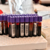 Crveni krst: Prošle godine prikupljeno više od 144.000 jedinica krvi 8