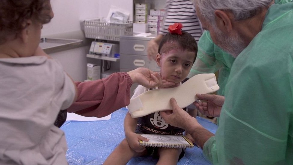 Posle meseci čekanja, devojčice iz Gaze stigle su u Italiju na lečenje opekotina 2 Zeina