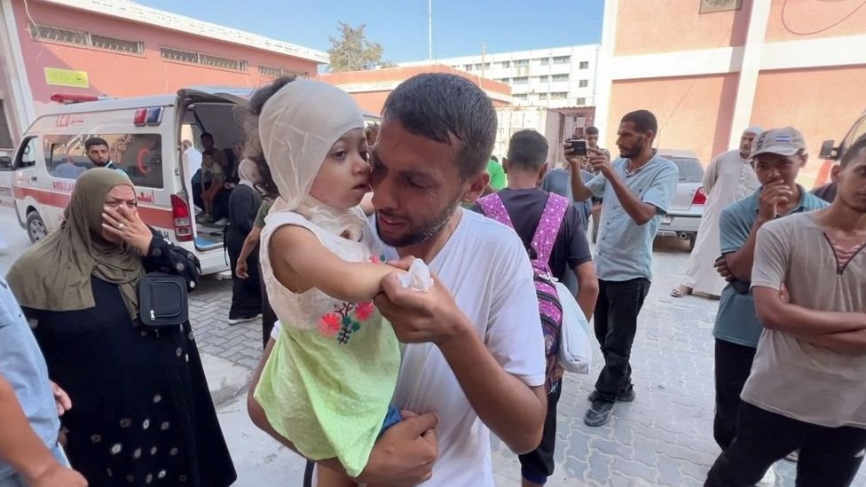 Posle meseci čekanja, devojčice iz Gaze stigle su u Italiju na lečenje opekotina 4 Dirljiv rastanak Zeine i njenog oca kome nije dozvonjeno da sa porodicom napusti Gazu