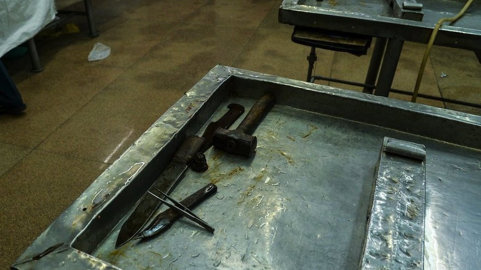 Indija: Doktorka veteranka za autopsije koja je videla smrt u svakom stadijumu života 4 U Indiji, alatke za autopsije variraju od visokotehnoloških do najosnovnijih