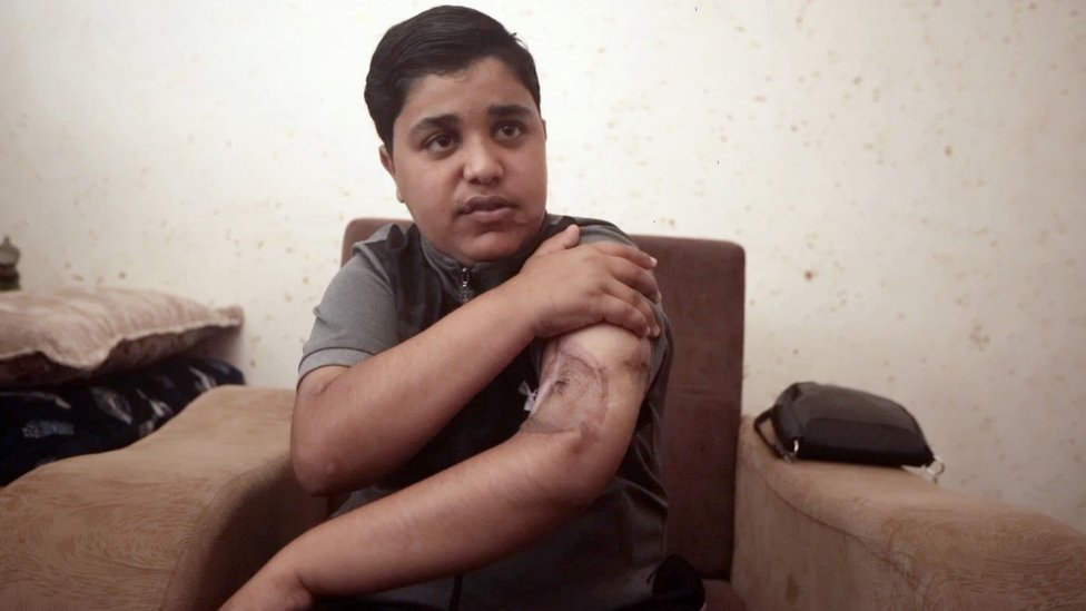 Izrael i Palestinci: Ranjeni, siročad i traumatizovani - od 7. oktobra životi su se promenili 4 abdulah