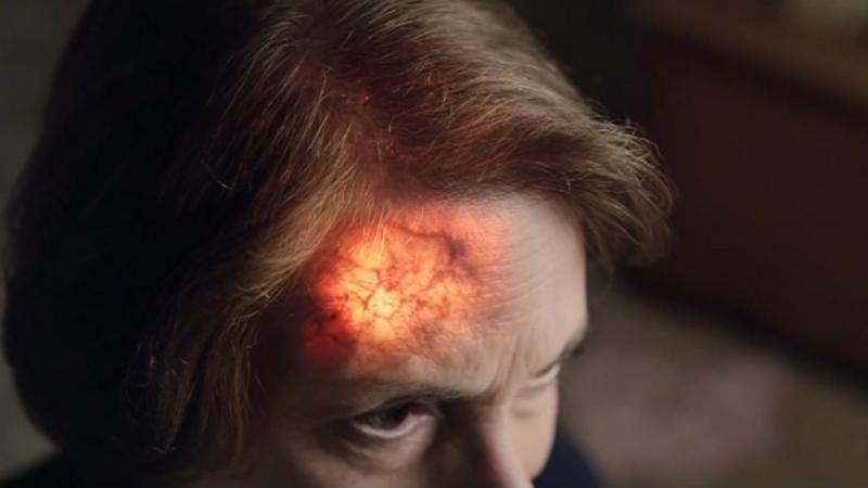 Šta sve treba da znate o moždanom udaru 1 Vreme igra važnu ulogu od trenutka kada pacijent uoči prve simptome moždanog udara