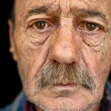 Neobičan način na koji vaša koža oblikuje vaše zdravlje 5