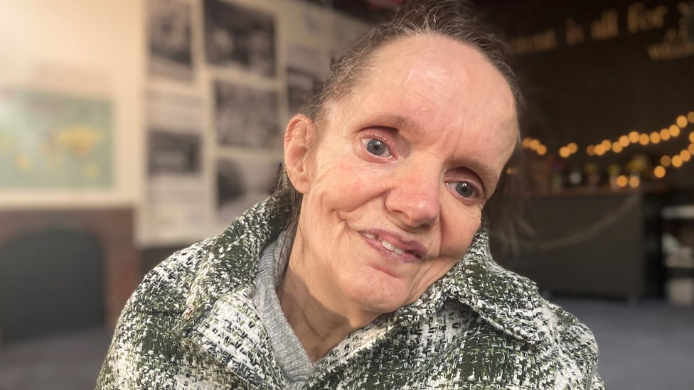 Neuroferitinopatija: Nova nada za sestre zatočene u vlastitim telima 2 A woman looks at the camera