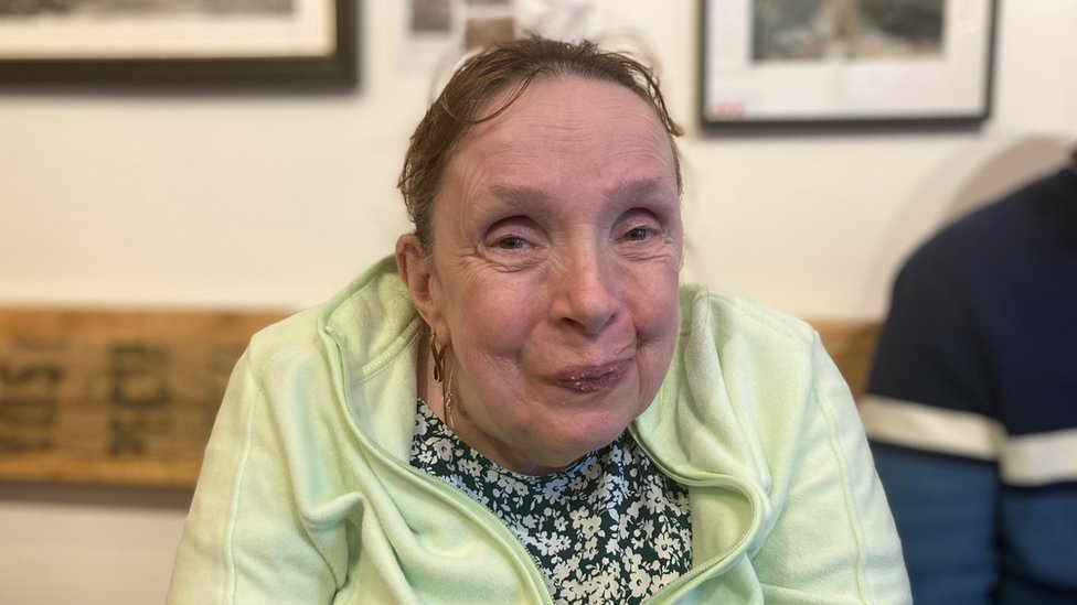 Neuroferitinopatija: Nova nada za sestre zatočene u vlastitim telima 5 A woman in a green hoodie smiles at the camera