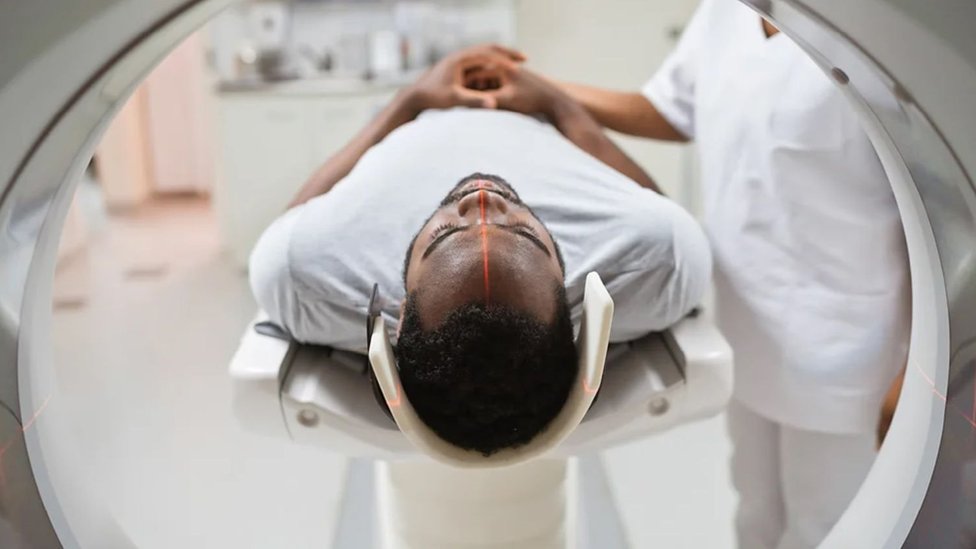 Koliko je rasizma u zdravstvu i medicini 1 skener