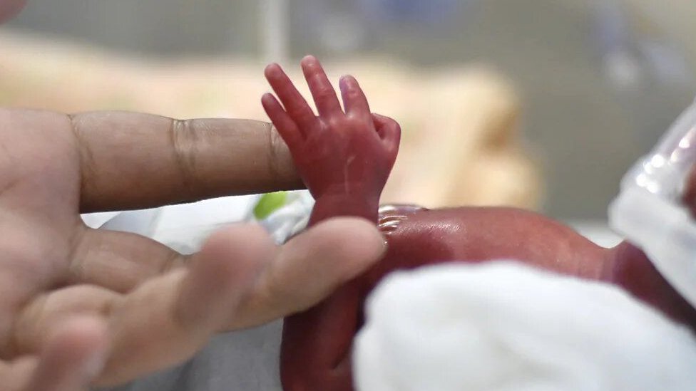 Medicina: Da li veštačka posteljica može da bude spas za prevremeno rođene bebe 2 Prst odrasle osobe dodiruje dlan prevremeno rođene bebe