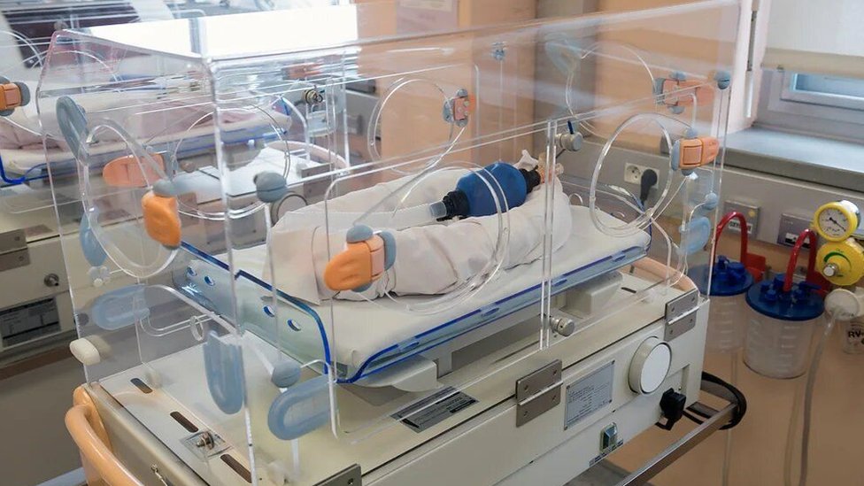 Medicina: Da li veštačka posteljica može da bude spas za prevremeno rođene bebe 5 Beba u inkubatoru