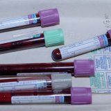 Kako sami da analizirate rezultate krvne slike? 7