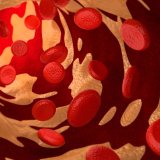 Kako regulisati povišen holesterol, objašnjava dr Gojković 11