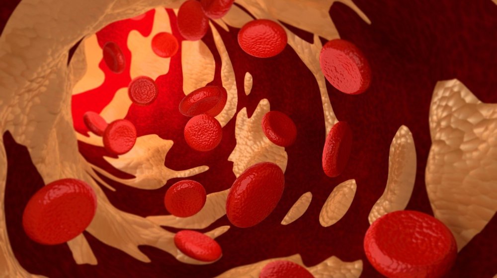 Ko holesterol može da smanji hranom, a ko mora da uzima lekove 1