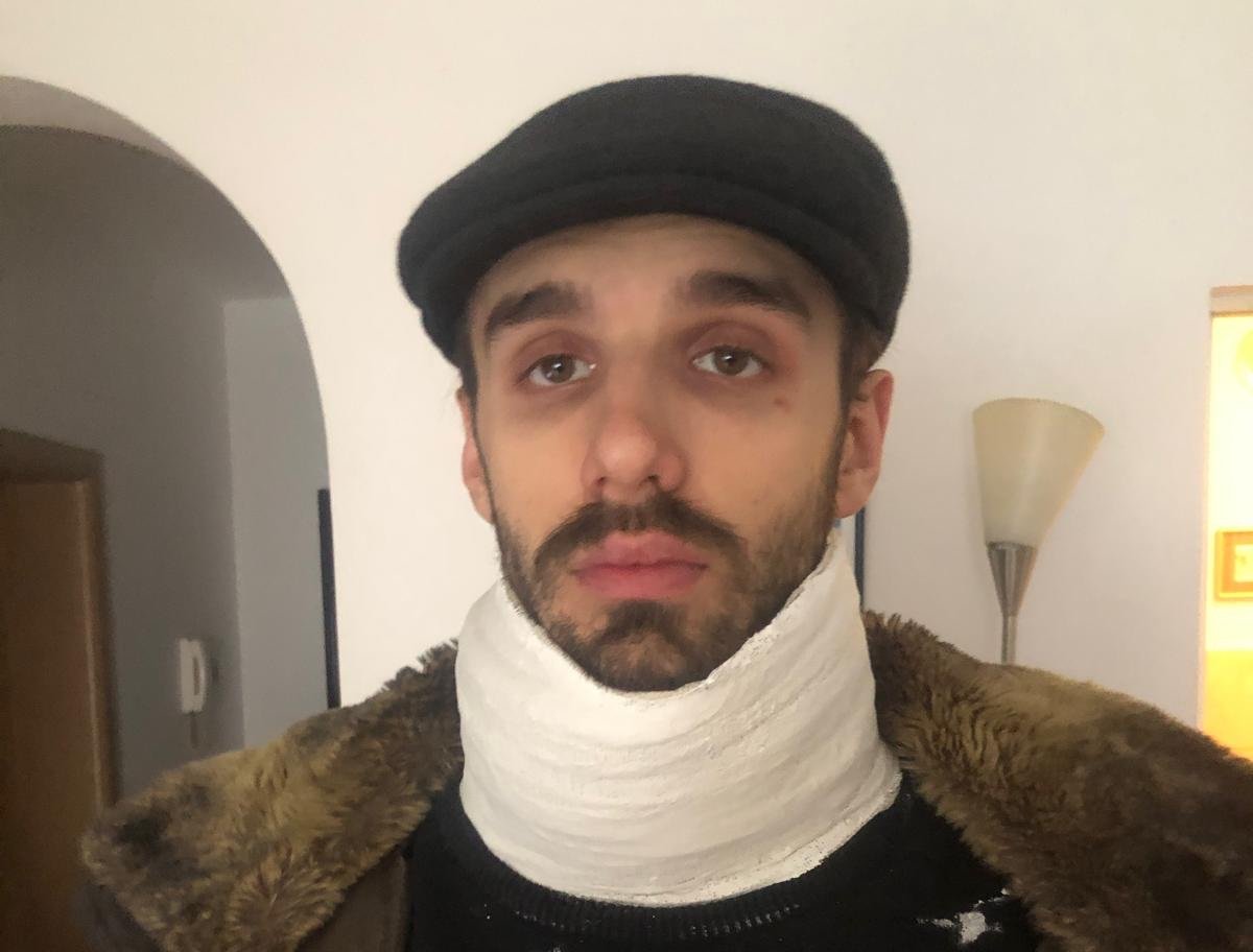 Lazar Srdić, student koji je napadnut kod Futoške pijace: "Žedni smo pravde i mnogo smo besni" 2 Lazar Srdić, student koji je napadnut kod Futoške pijace: "Žedni smo pravde i mnogo smo besni" 2