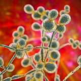 Namirnice koje treba da jedete kako biste izlečili kandidu 5