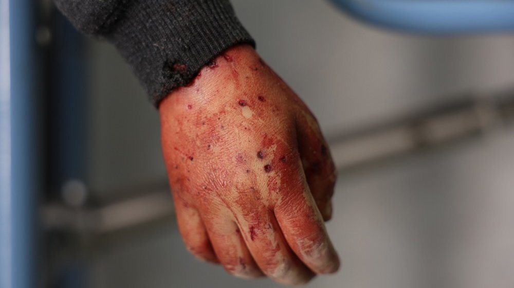 Opservatorija: Više od 528.500 mrtvih za gotovo 14 godina rata u Siriji 1