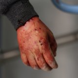 Opservatorija: Više od 528.500 mrtvih za gotovo 14 godina rata u Siriji 5