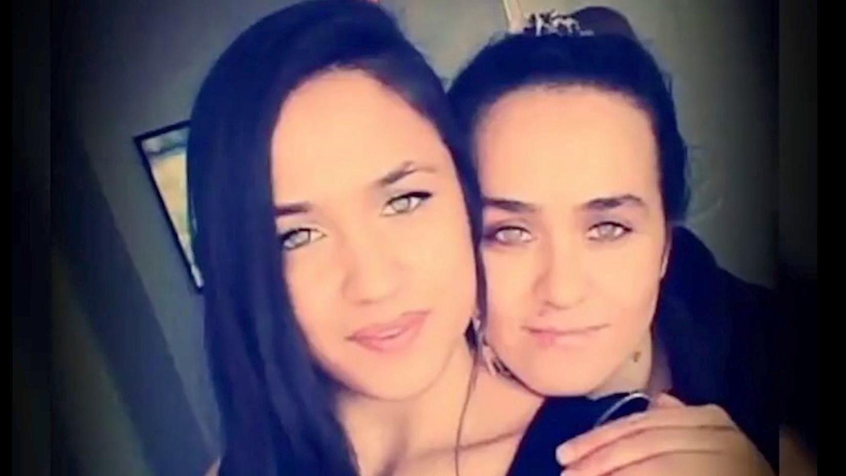 'Povratak iz mrtvih': Oporavak pevačice kojoj je ljubomorni bivši pucao u glavu 5 Mutlu i Dilek