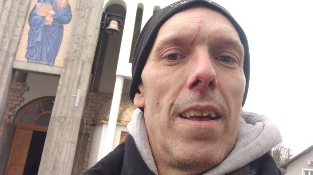 Jovan Kovačević, zamenik predsednika opštine Vrbas: Prvo okačio crvenu šaku koja pokazuje srednji prst, pa fizički nasrnuo na svog sugrađanina? 1