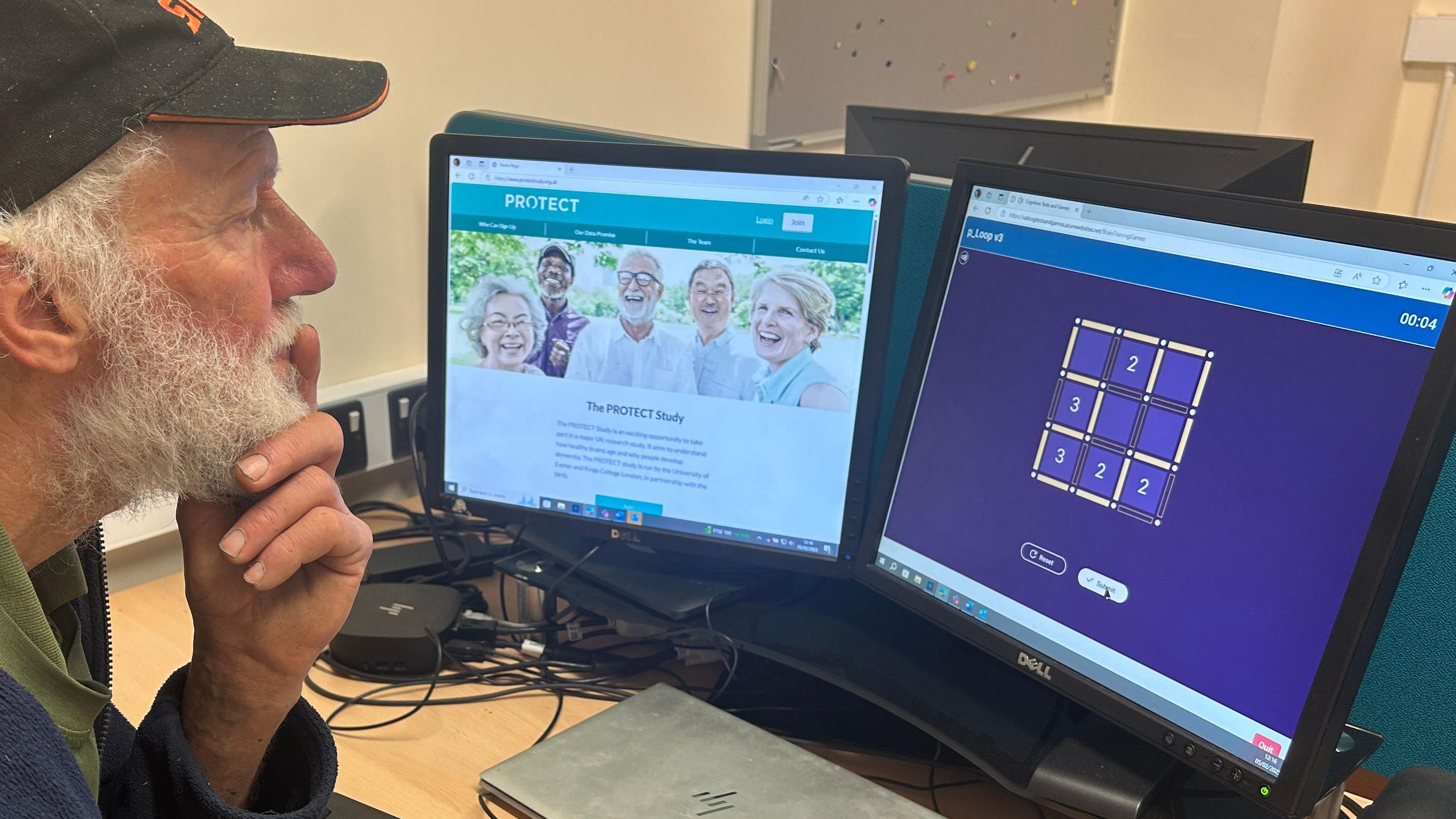 Bakterije u ustima 'mogu da ukažu na zdravlje mozga u budućnosti' 1 Stariji muškarac gleda u kompjuter