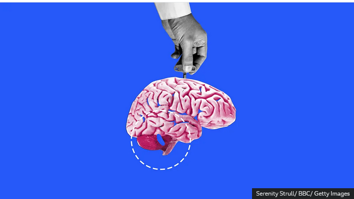 Kako plava tačkica u mozgu reguliše vaše spavanje 3 Ilustracija plave boje sa roze mozgom i ljudskom rukom koja okreće šraf